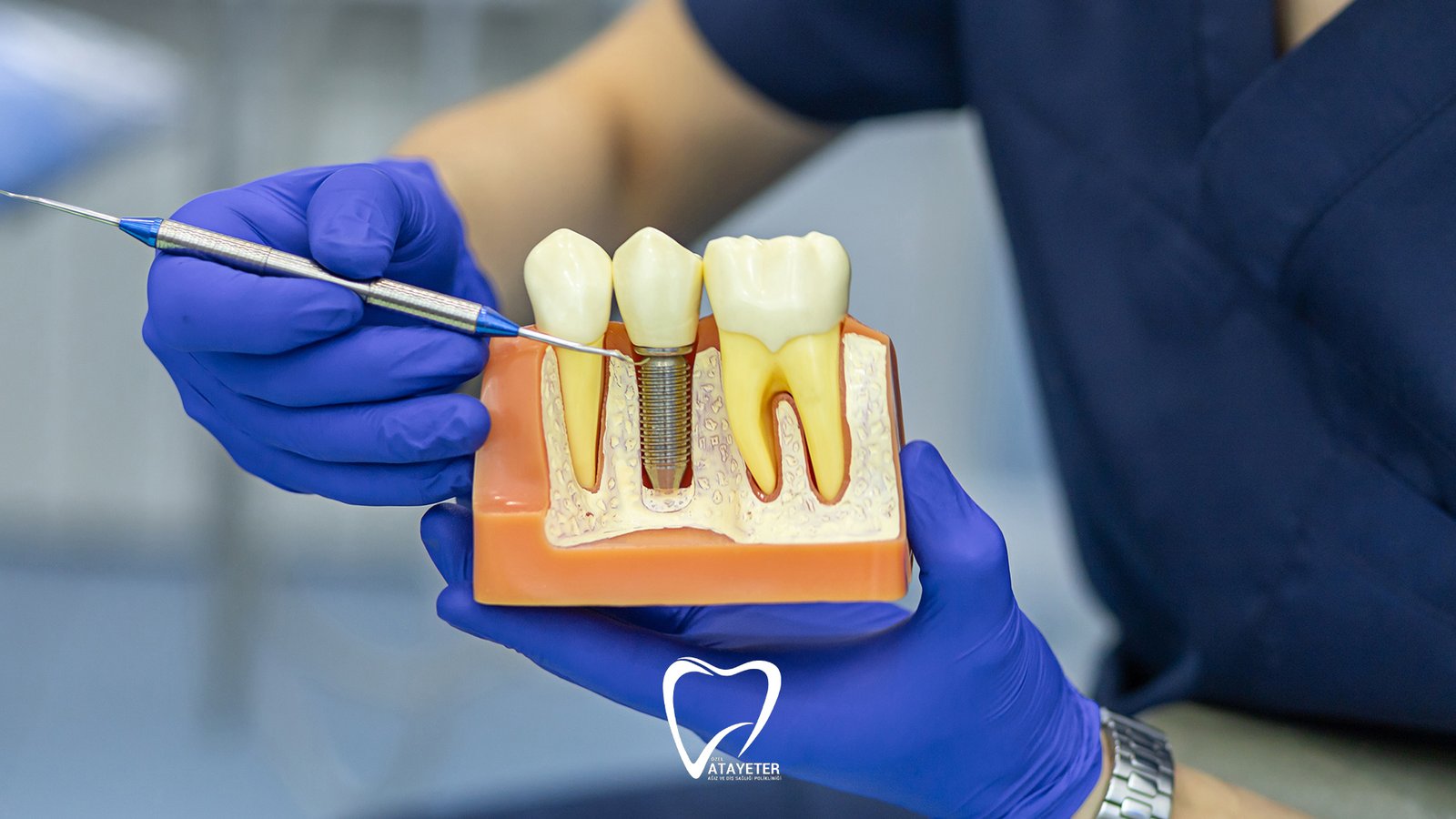 Dental Implant Treatment