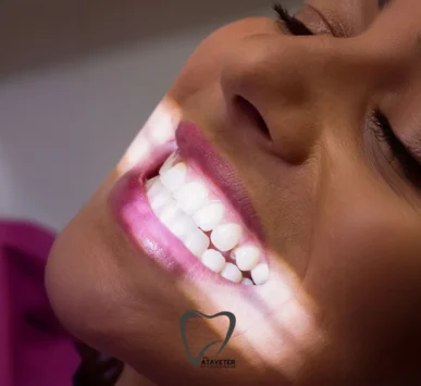 Teeth Whitening
