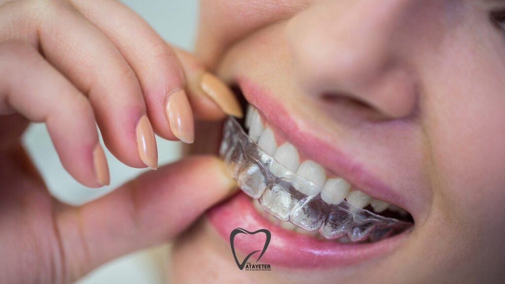 Şeffaf Plak Tedavisi