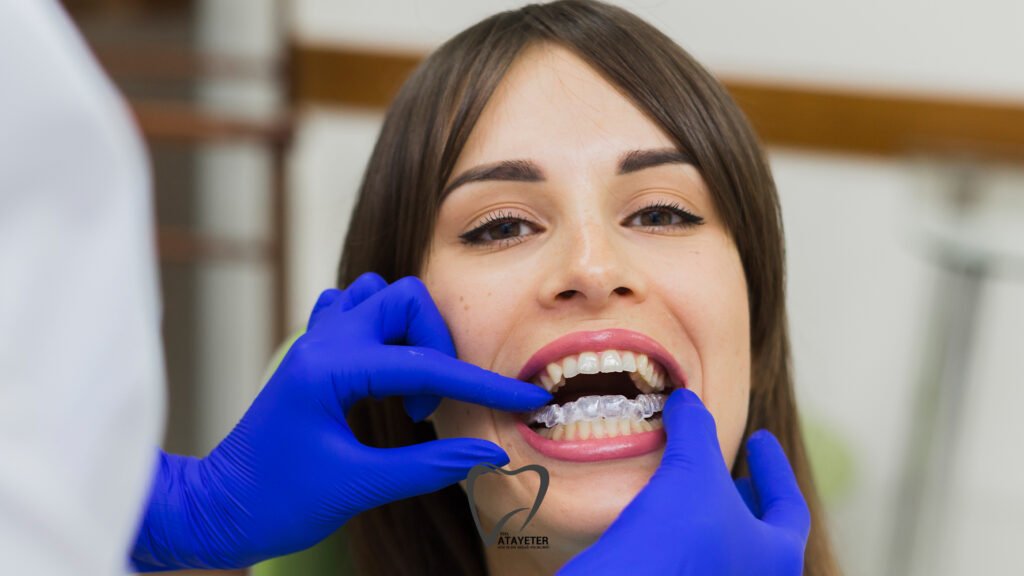 Şeffaf Plak Tedavisi