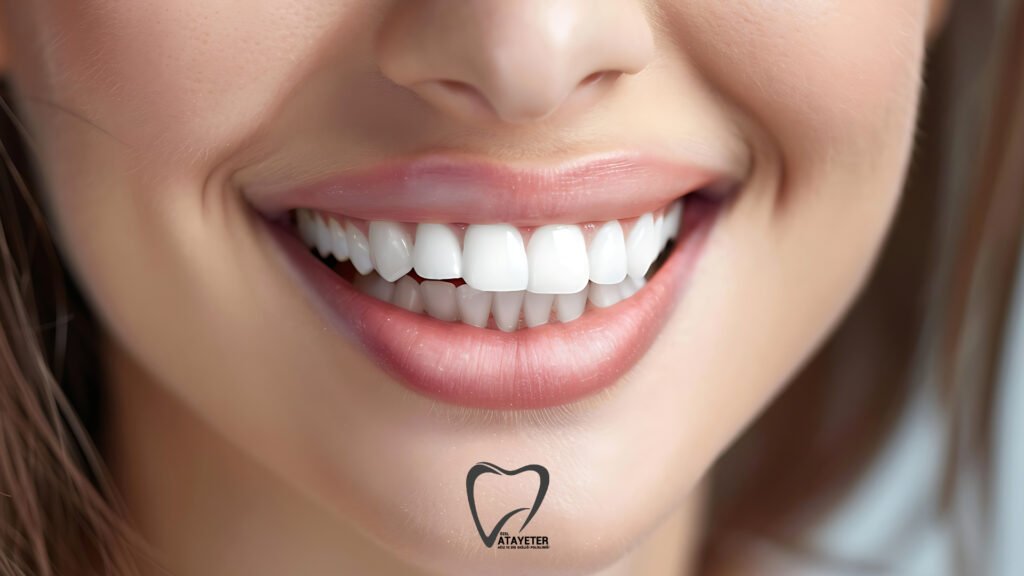 What is Smile Design