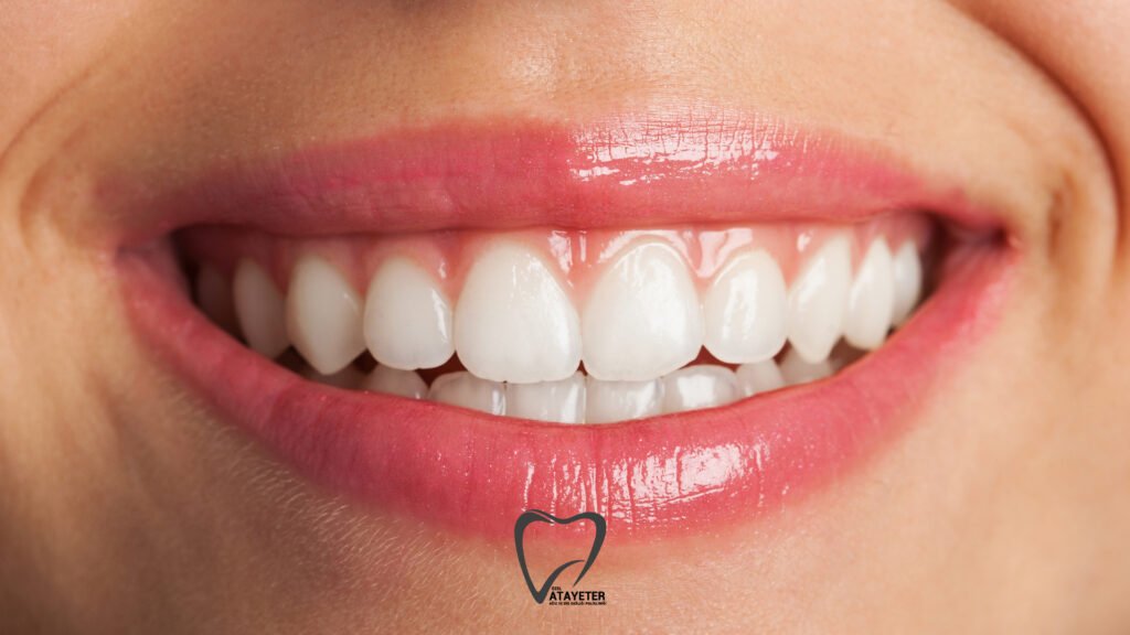 What is Smile Design