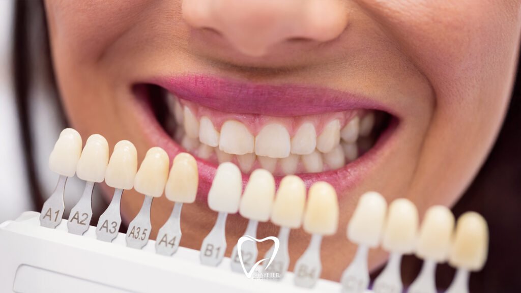 What is a Zirconium Crown