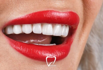 Zirkonyum Kaplama Nedir