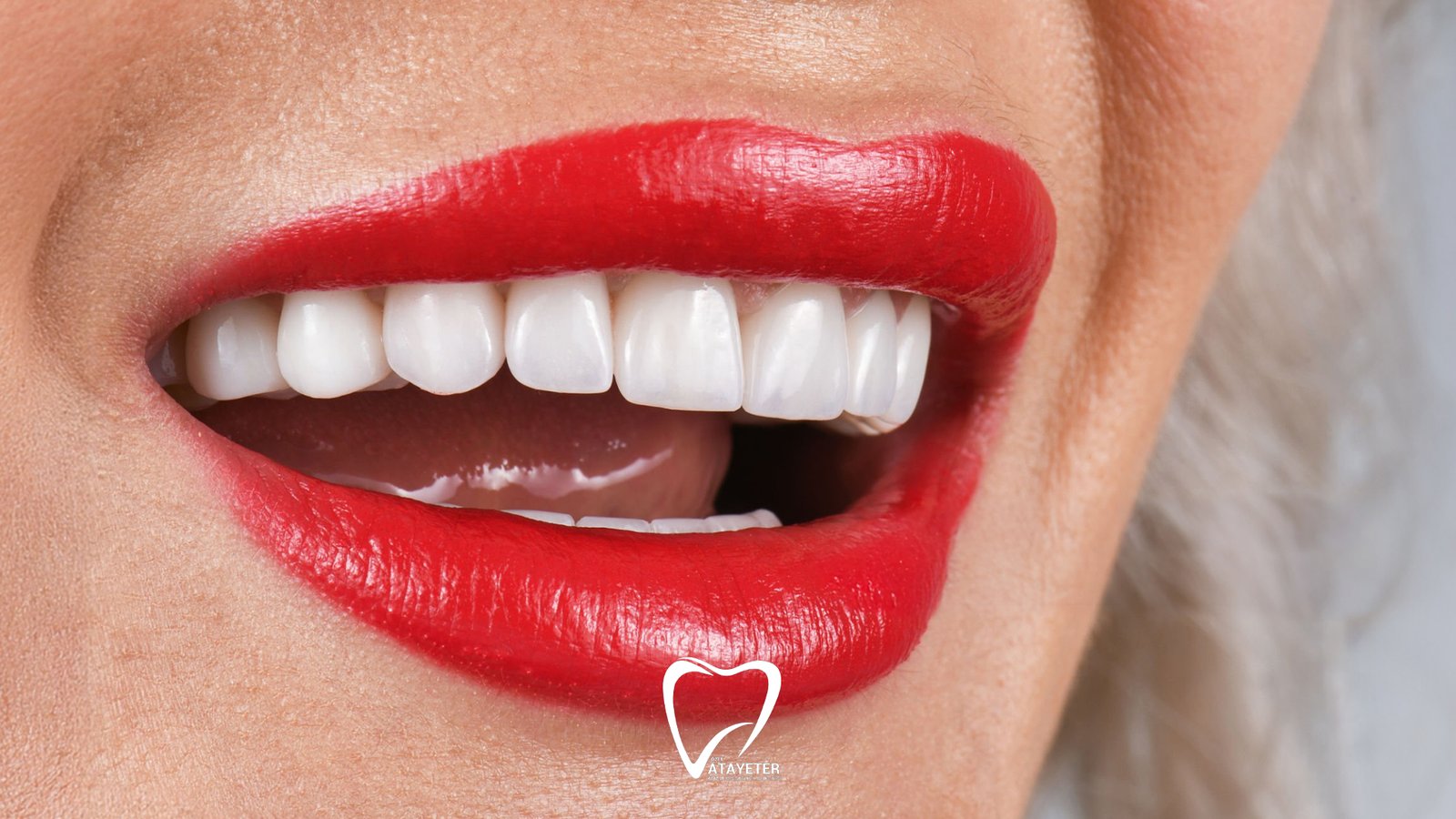 Zirkonyum Kaplama Nedir