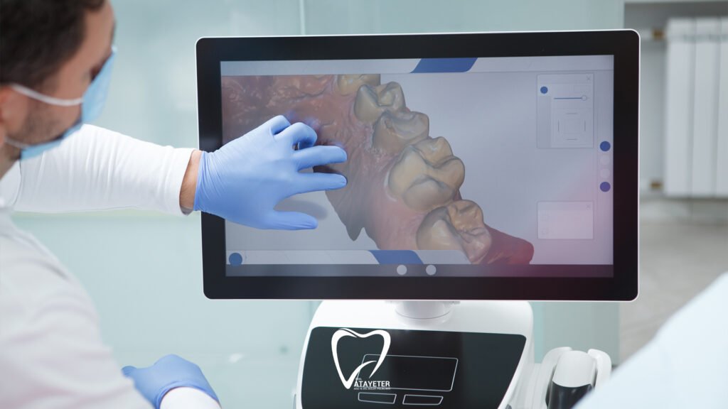 What is a Digital Impression