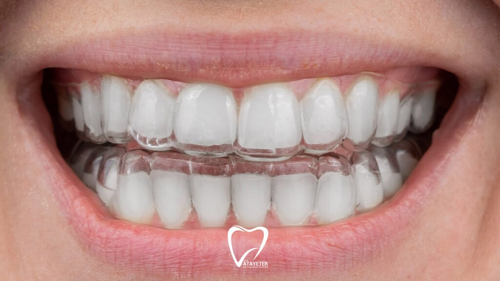 What Is a Night Guard