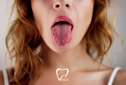 Ağız Kuruluğu Neden Olur