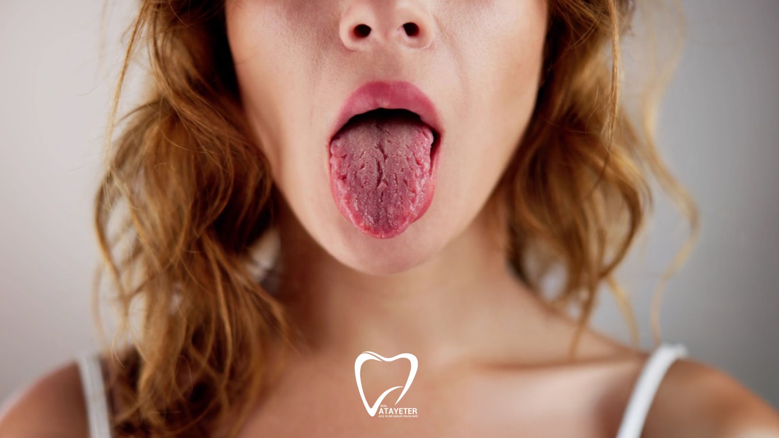 Ağız Kuruluğu Neden Olur
