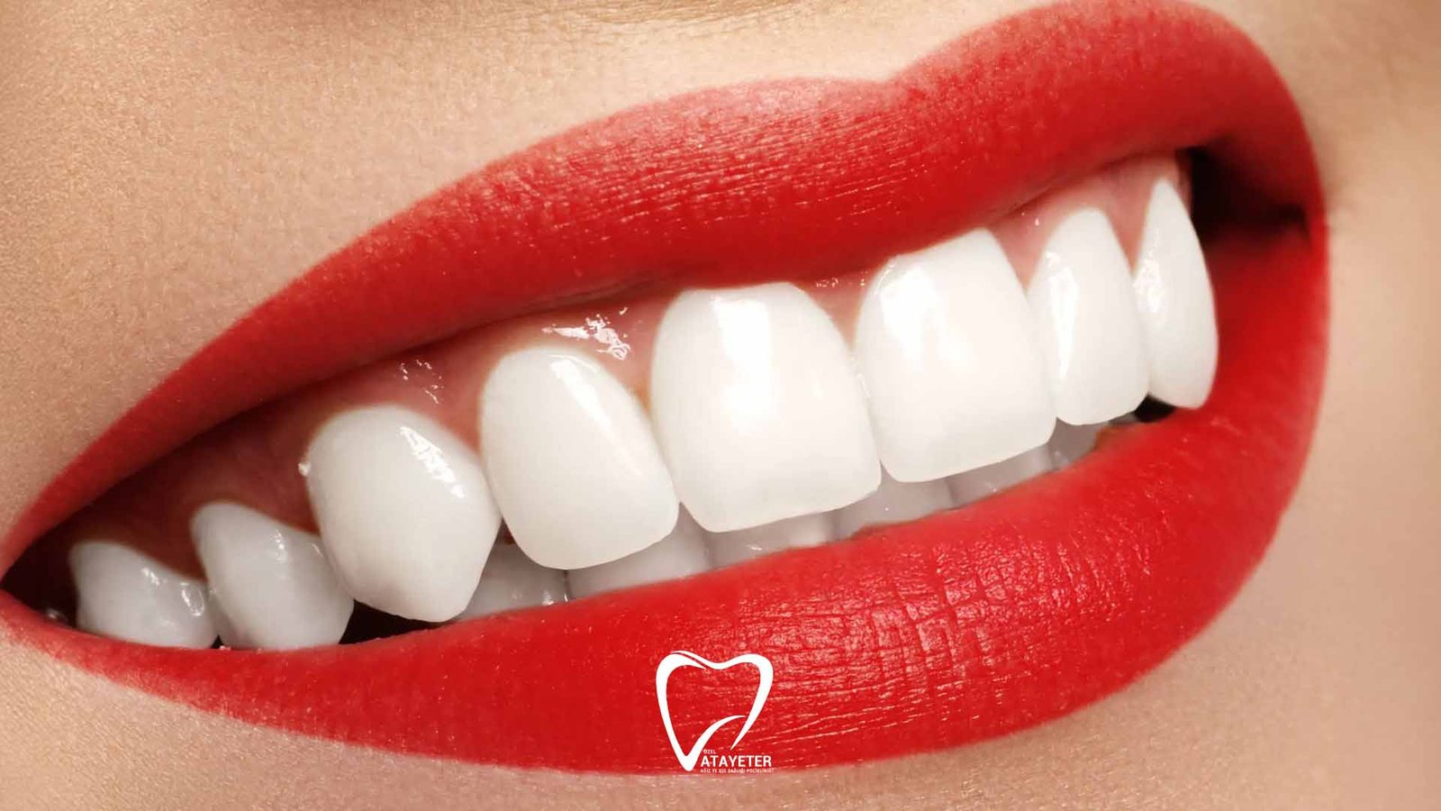 Zirkonyum ve Lamine Arasındaki Farklar