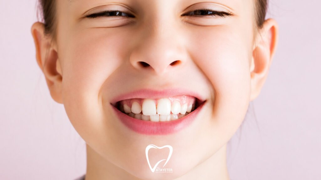 What Is Malocclusion