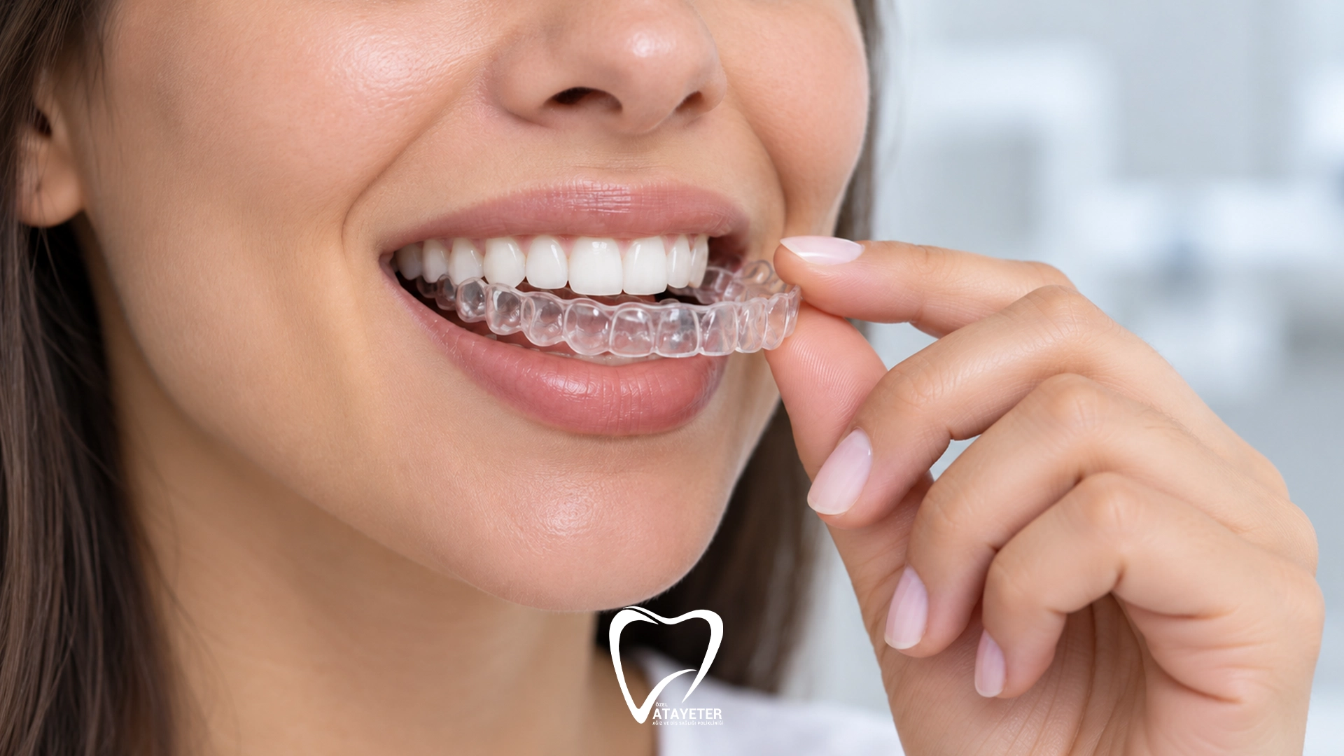 Clear Aligners vs Braces: 7 Key Differences | Atayeter Dental Clinic